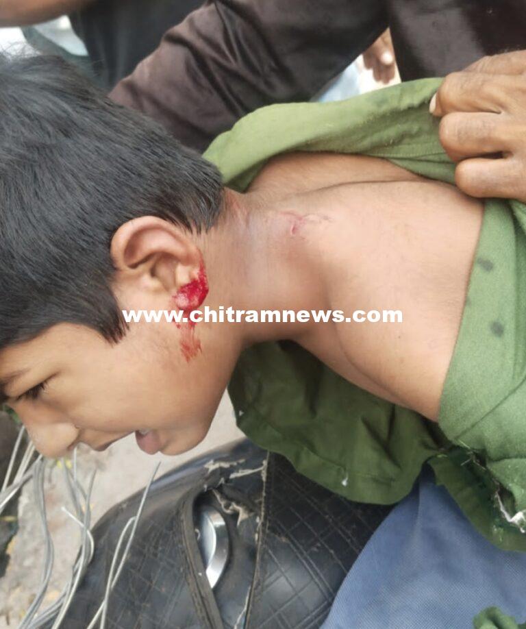 బాసరలో పిచ్చికుక్కల స్వైర విహారం